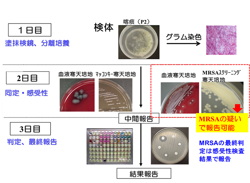 微生物検査の流れ